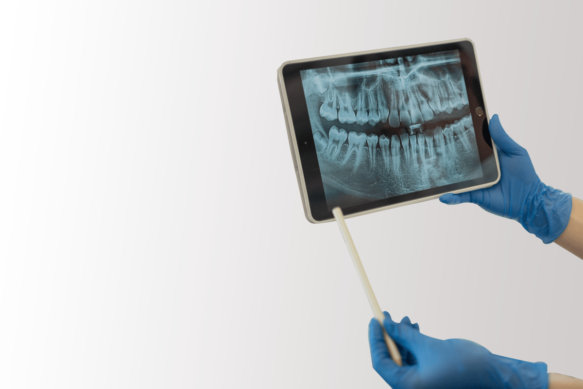 Global Dental Technology | Ingersoll Dental | Ontario